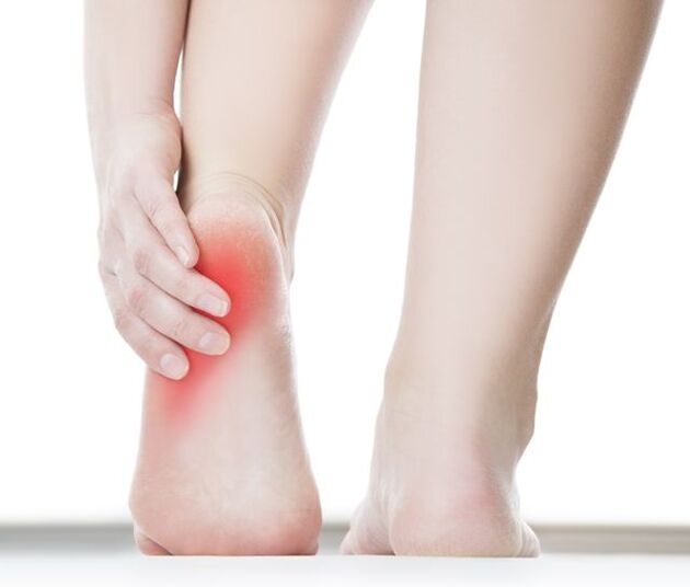 脚跟上的疣会引起剧烈疼痛